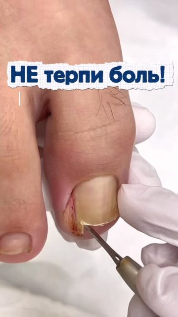 #подолог #подологалматы #алматы