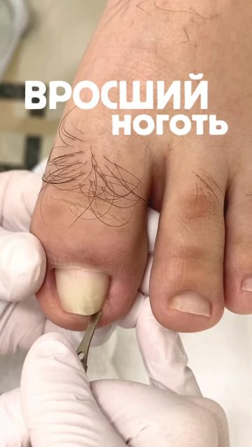 #подолог #подологалматы #алматы